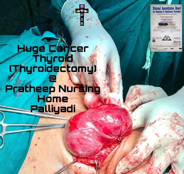 Operative photograph from thyroid surgery