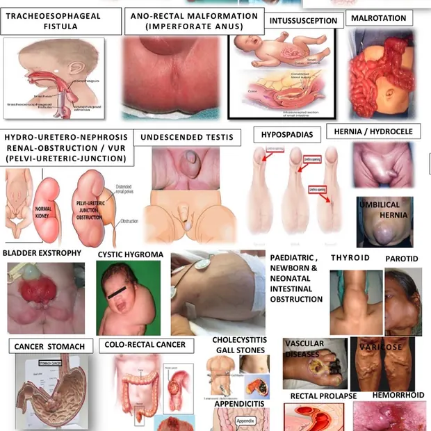 Hospital chart showing surgical conditions treated at the centre